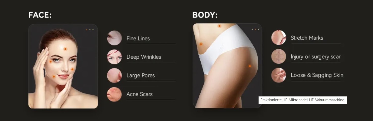 RF Microneedle Fractional Machine mit Vakuum – neueste Generation der fraktionierten MikronadelRF-Technologie 2 MHz – Bild 7