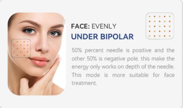 RF MICRONEEDLING GERÄT 2 MHz – Bild 6